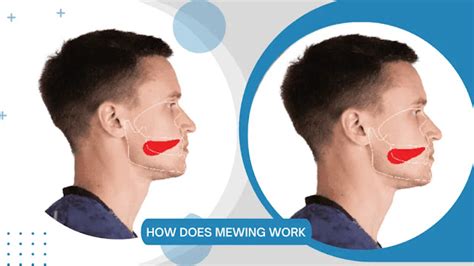 mewing danger|Everything You Need to Know About the Mewing Craze .